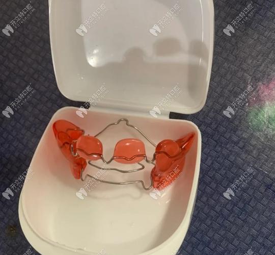 儿童地包天矫正器多少钱_深圳儿童地包天矫正多少钱_儿童地包天矫正可以用医保吗