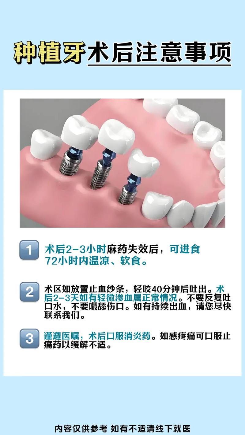种植牙齿好_60岁的人种植牙好吗_种植牙技术好