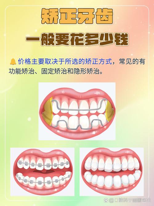 矫正牙齿费用明细_半口矫正牙齿多少钱_牙齿矫正口腔