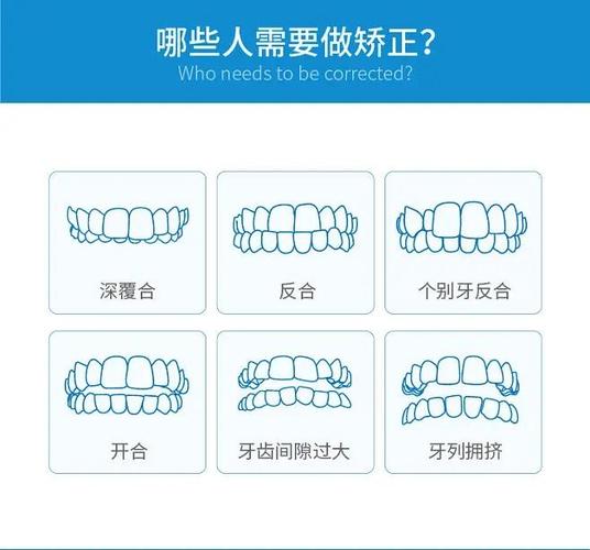12岁牙齿矫正一般需要多少钱_牙齿矫正钱一般需要多久_牙齿矫正钱一般需要多长时间