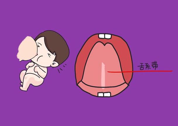 婴儿嘴臭怎么办_婴儿嘴臭是什么原因_婴儿嘴巴臭是什么原因引起的