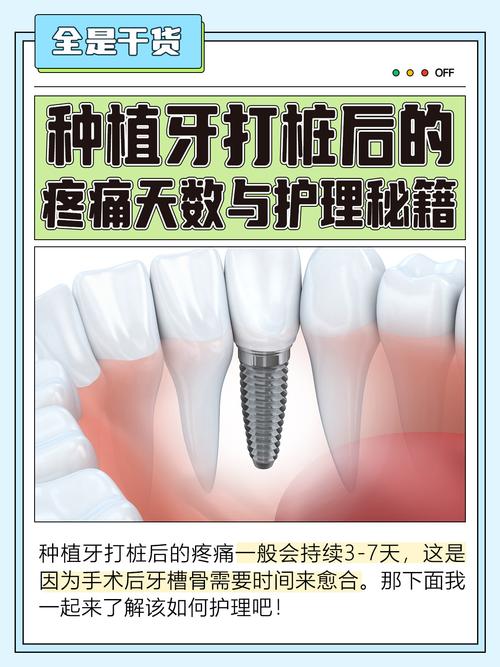 种牙打桩后禁忌_种牙打桩后可以同房吗_种植牙打桩后要疼几天