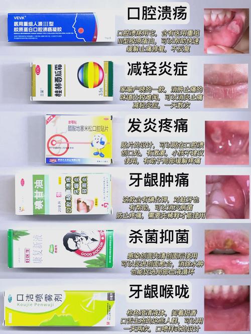 小孩口腔溃疡吃什么好的快？收下这份家庭偏方与饮食指南，轻松缓解娃的疼痛