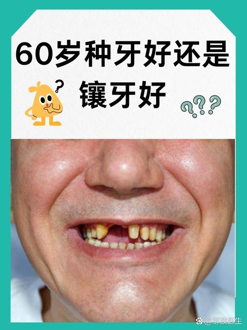六十岁老人适合种牙吗_老年人适不适合种牙_老年人种牙的利弊