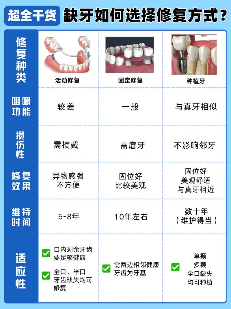 补牙和种牙哪个贵_补牙与种牙区别_补牙跟种牙的区别