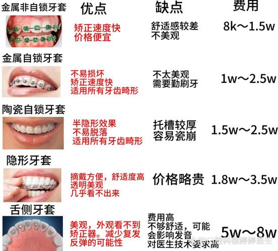 暴牙矫正费用大概多少钱 2026价格参考