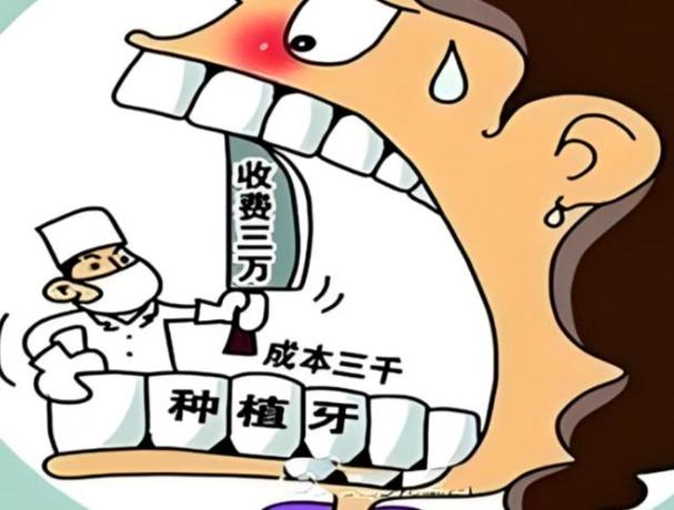 种植牙要收几次钱_种植牙钱是一次交完吗_两颗种植牙要多少钱
