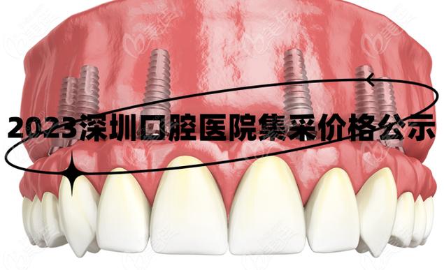 深圳种植牙集采后能省多少钱_深圳种植牙可以社保吗_深圳种植牙可以刷医保卡吗