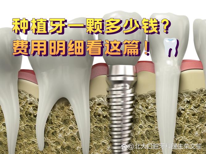 西安种牙2026年最新报价：单颗2600到4900元真实情况揭秘