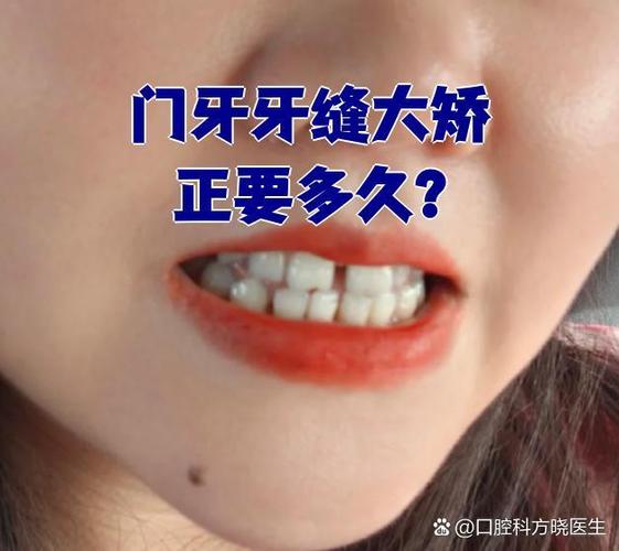 28岁还能做矫正牙齿吗_牙齿矫正还能做面部提升吗_牙齿矫正还能做ct吗