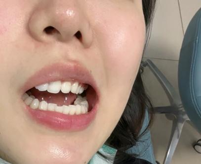 杭州口腔医院拔智齿价格_杭州口腔拔牙最厉害三个医院_杭州口腔医院拔牙