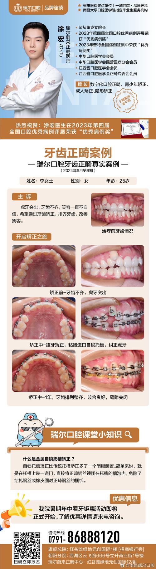 成人龅牙矫正选医院还是诊所？关键看医生资质和案例对比