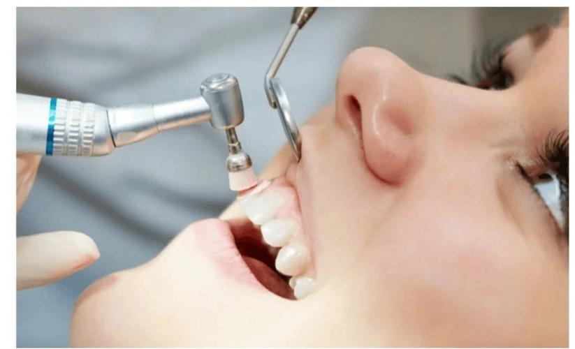 洗牙的超声波有辐射吗_超声波洗牙怎么洗_声波洗牙器有用吗