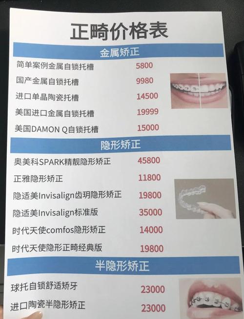 15岁女孩牙齿矫正多少钱 2026年费用明细与省钱攻略