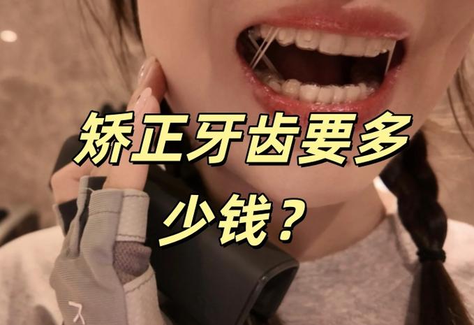 14岁牙齿矫正一般需要多少钱_牙齿矫正是不是要很多钱_牙齿矫正钱一般需要多长时间