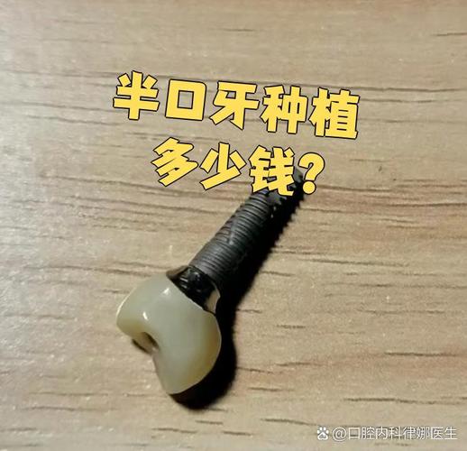 深圳宝安牙科诊所前十名_深圳宝安中老年半口种牙价格_深圳宝安牙医