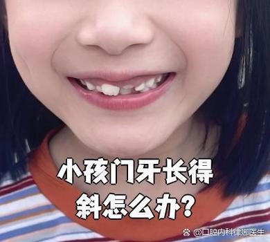 深圳孩子换牙门牙歪斜怎么办？专业干预指南与避坑建议