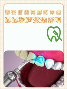 自己用超声波洗牙安全吗？洗牙是医疗行为，别自己瞎搞