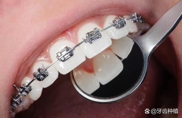 成人矫正牙齿哪家好？资深正畸医生比医院大小更重要