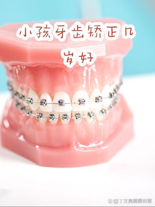 16岁牙齿矫正晚吗？医生：抓住黄金期，效果一样好