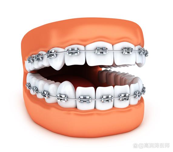 16岁矫正牙齿，到底晚不晚？听听牙医怎么说