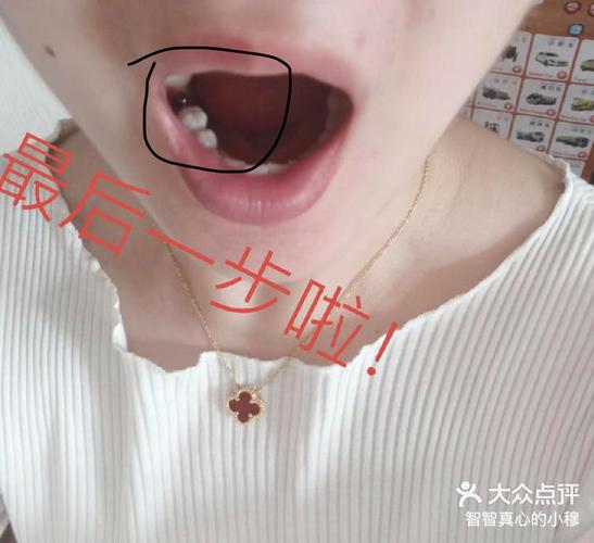 宝安新安种植牙哪家医院好？真实体验告诉你
