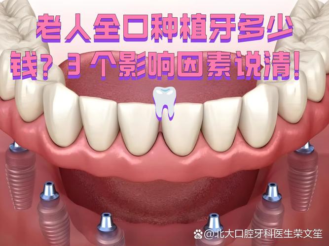 沙井全口种植多少钱？要种几颗？一次说清