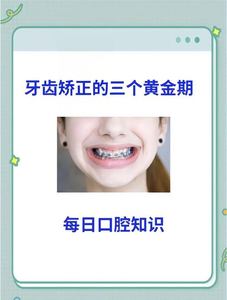 16岁矫正牙齿真的晚吗？抓住黄金期的尾巴，效果一样好