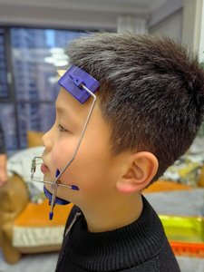 晚上矫正牙齿_16岁正畸牙齿晚不晚_正畸可以改善晚上磨牙吗