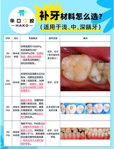 种材料补牙用有牙套吗_补牙用的材料有几种_补牙用到的材料