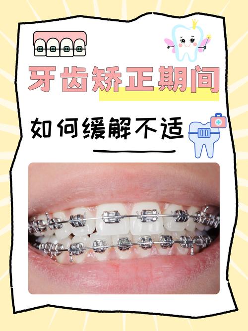 牙齿矫正好做几次_40岁了做牙齿矫正好吗_牙齿矫正做哪种好