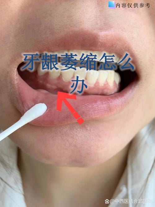 不种牙会怎么样_种的牙会坏吗_牙种的牙