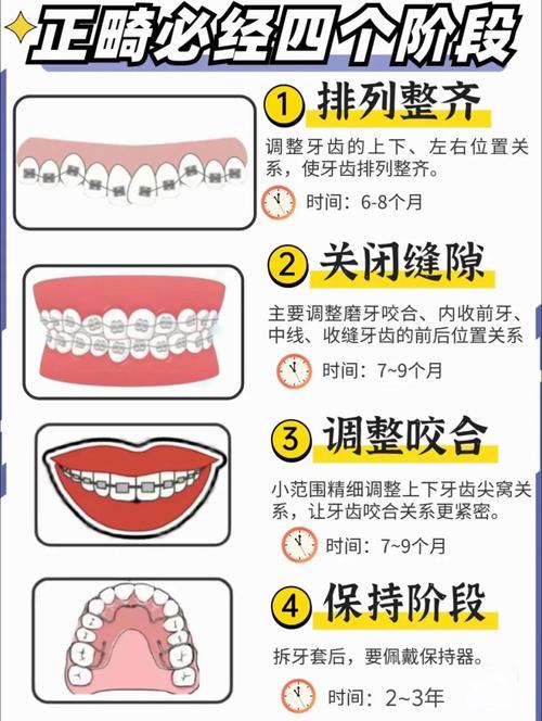 成年人牙齿如何矫正_成人矫正牙齿有年龄限制吗_成年牙齿矫正人会变老吗