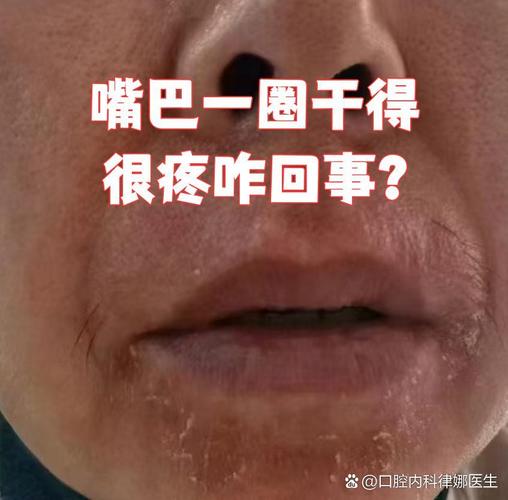 孩子嘴巴干燥怎么回事_嘴巴干燥起皮怎么办_嘴巴干燥回事孩子吃什么好