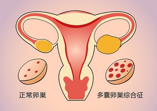 HIV治疗后可以生孩子吗_HIV可以生孩子吗_hiv患者可以生孩子吗