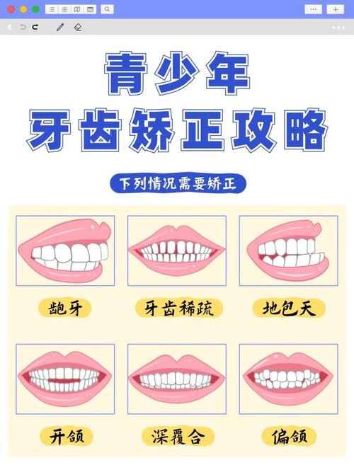 20岁以上牙齿可以矫正吗_牙齿矫正期间可以做牙冠吗_牙齿矫正以上可以吃东西吗