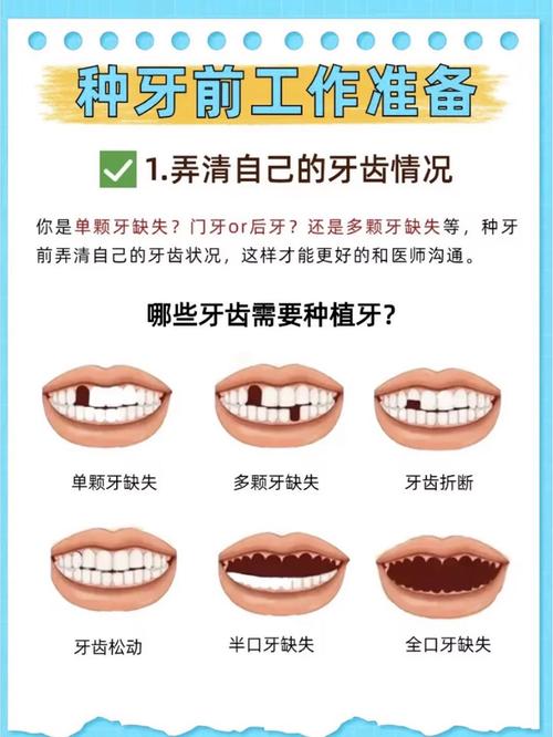 牙种好后能随便吃东西吗_哪家种牙好_牙种好后还会出现什么问题