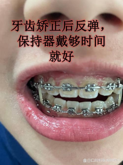 40多岁做牙齿矫正，晚不晚？效果好吗？