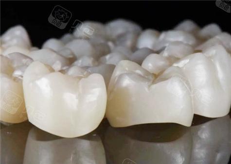 深圳全瓷牙哪家牙科靠谱_深圳烤瓷牙哪家做的好_深圳烤瓷牙
