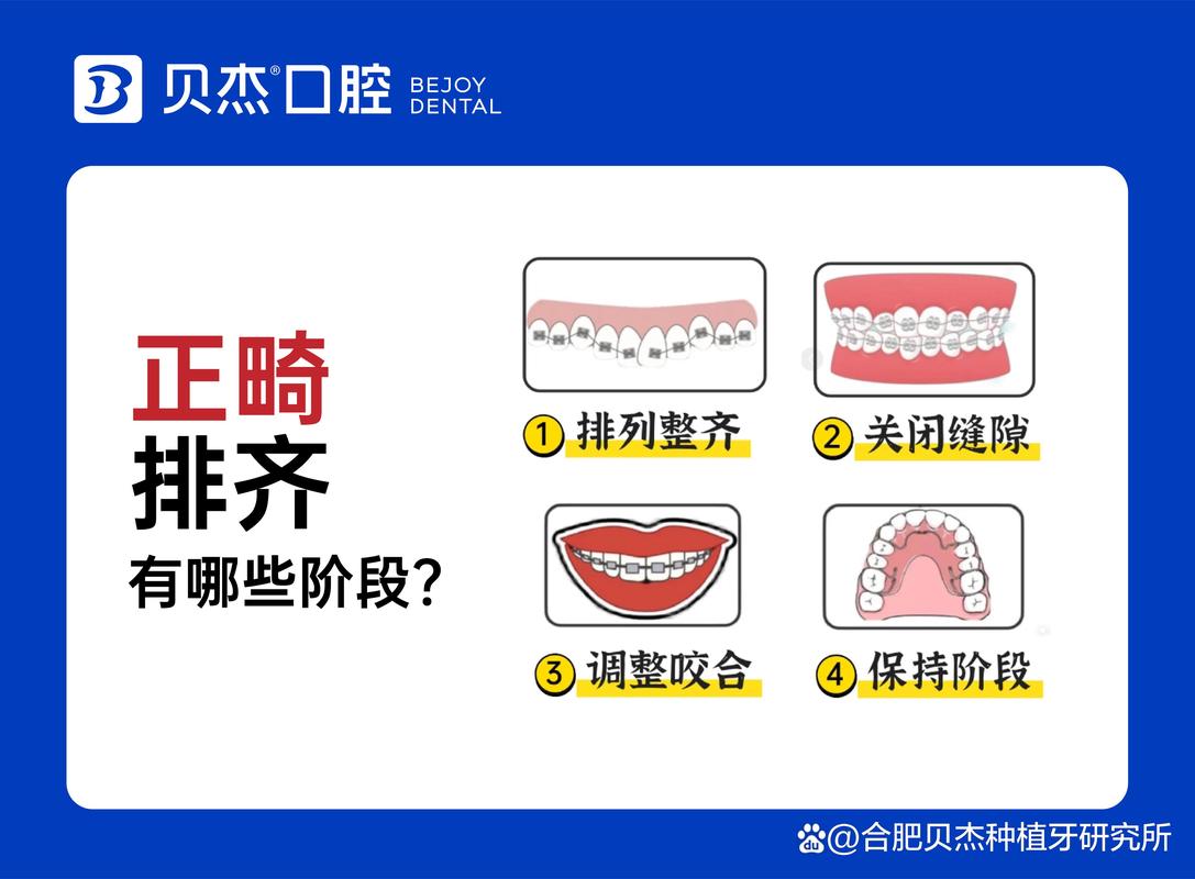 儿童牙齿排列不齐去哪家医院矫正效果最好？