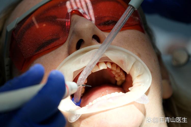 日本检查口腔视频_日本口腔嘴舌检查_口腔科检查舌头要空腹吗