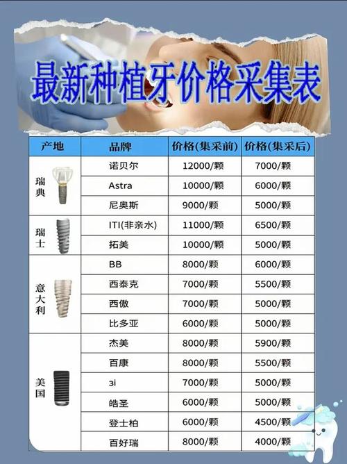 种植牙费用明细表_3个种植牙价目表_2021年种植牙标准价格表