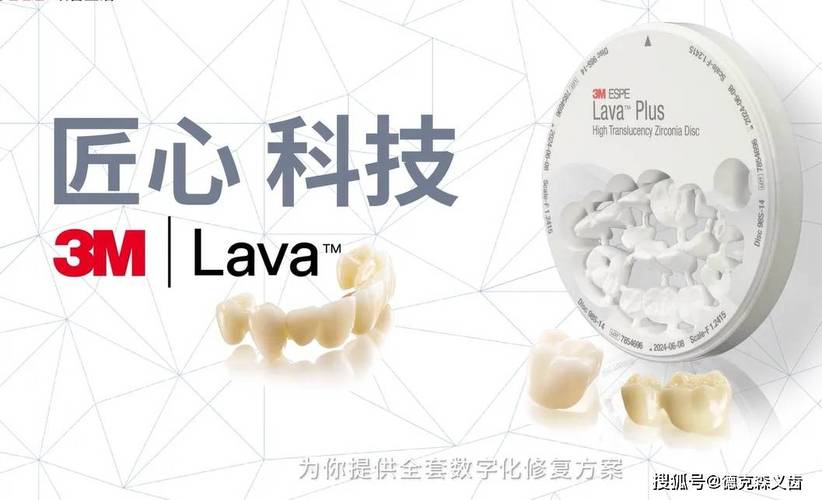 深圳全瓷牙厂家_深圳烤瓷牙_深圳全瓷牙哪家牙科靠谱