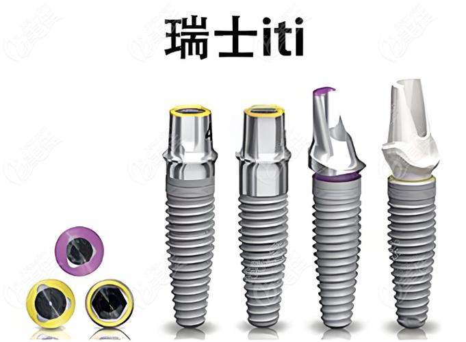 欧美种植牙品牌 ITI / 诺贝尔 费用 2026_诺贝尔种植牙哪个国家品牌_诺贝尔种植牙材质好吗