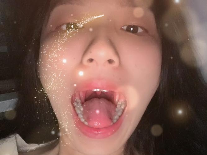 口腔视诊顺序_口腔检查第一视角_口腔检查视频合集