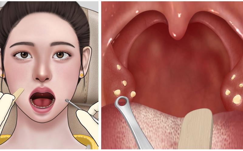 口腔检查第一视角_口腔视诊顺序_口腔检查视频合集