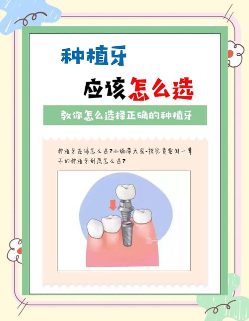 广州种牙推荐_广州哪里做种牙好_广州种牙贵吗