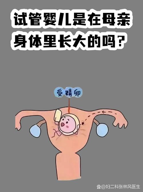 试管婴儿常见误区有哪些 专家一次说清