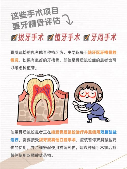 骨质疏松能种牙吗 掌握这几点放心种