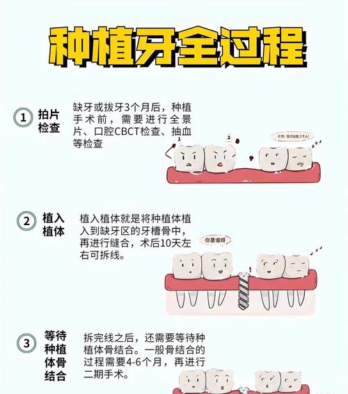牙槽骨骨质疏松种植牙_种牙医生说骨质疏松_骨质疏松能种牙吗